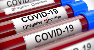 Режим работы офиса во время эпидемии COVID-19